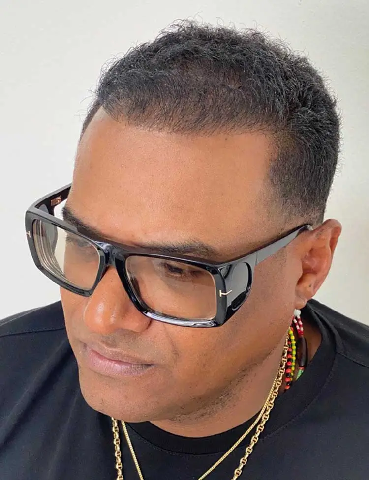 hair-restoration-miami-after-21021.webp